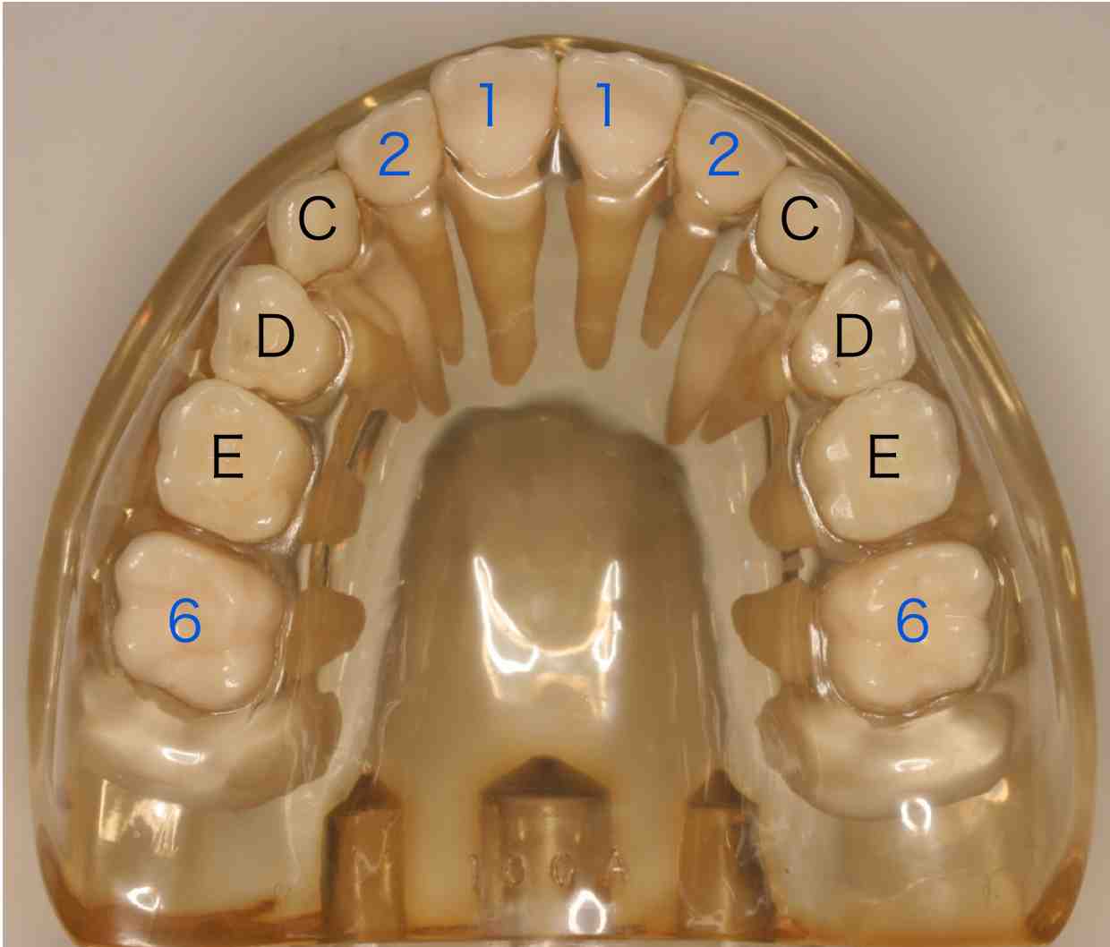 側方歯群